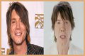 John Rzeznik Facelift | Goo Goo Dolls Frontman Plastic Surgery Before And After